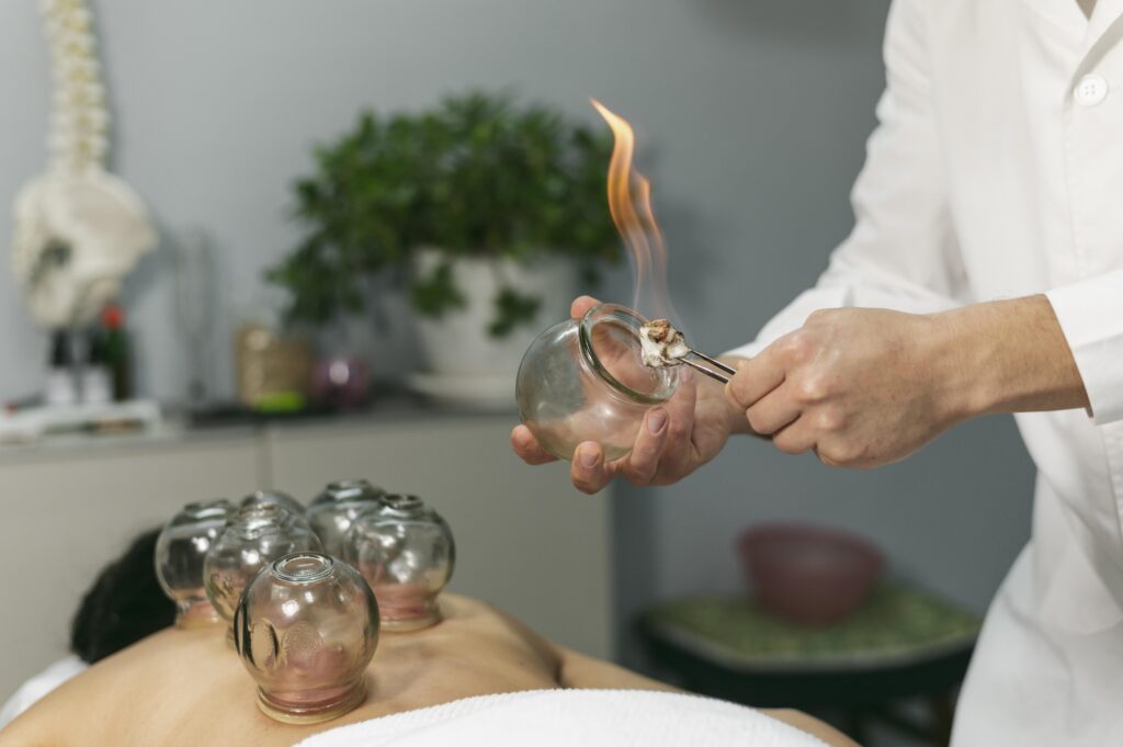 Thérapie ventouses à Genève chez Ayün Terapia